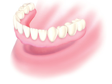 Proteza całkowita ruchoma